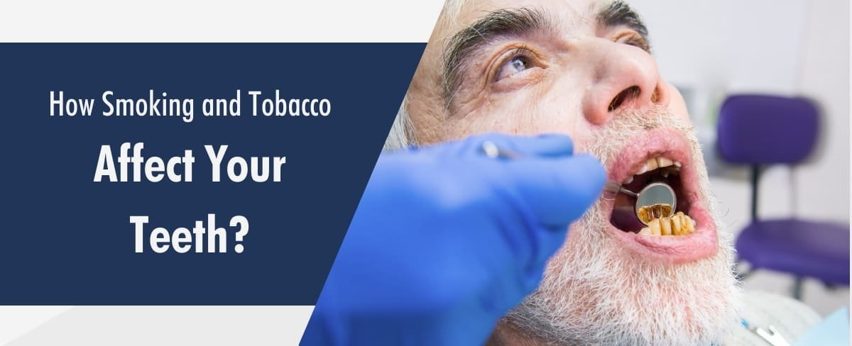 How Smoking and Tobacco Affect Your Teeth