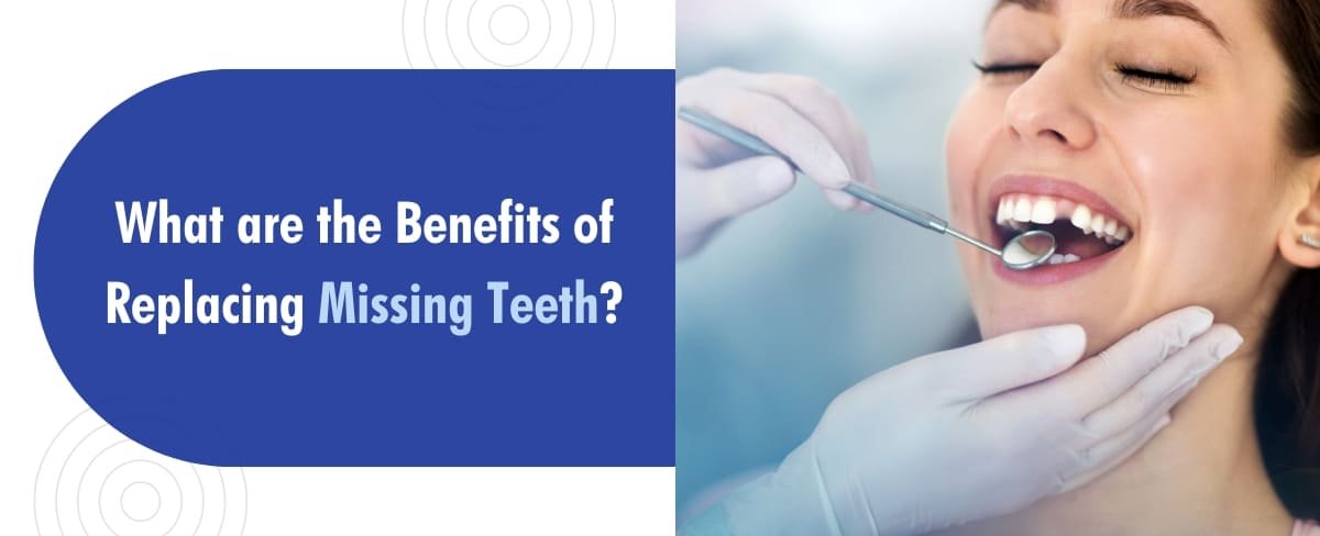 Benefits of Replacing Missing Teeth