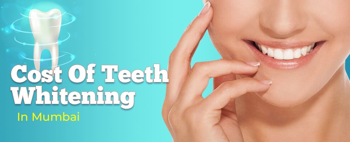 Cost Of Teeth Whitening in Mumbai