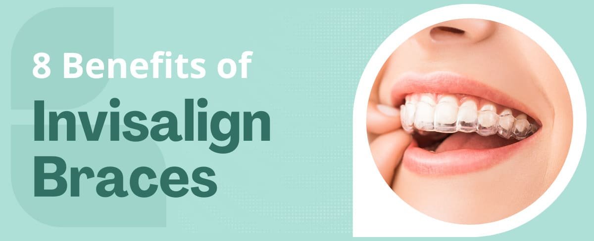 8 Benefits of Invisalign Braces