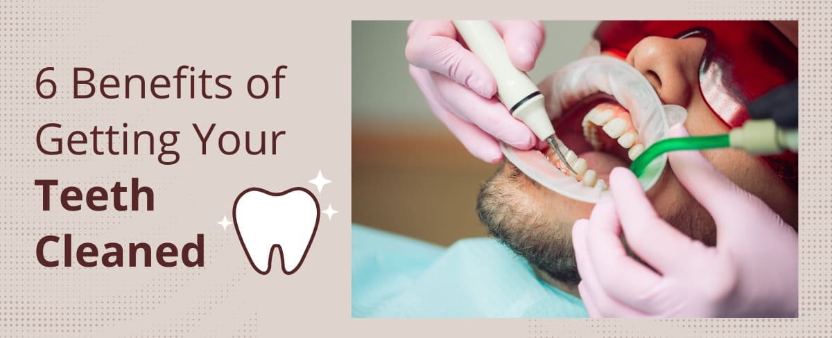 6 Benefits of Getting Your Teeth Cleaned