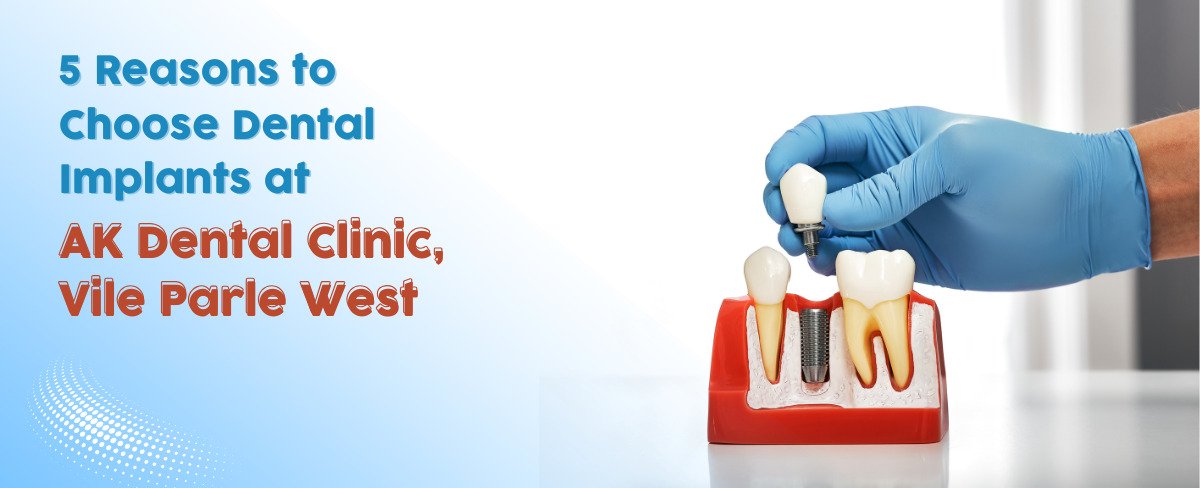 5 reasons to choose dental implants