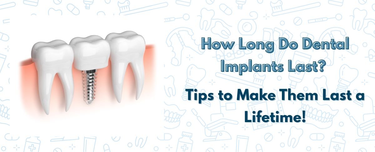 tips to make dental implants last a lifetime