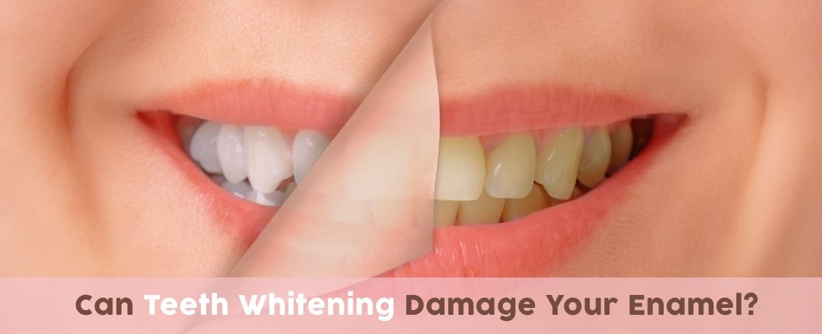 Can teeth whitening damage your enamel