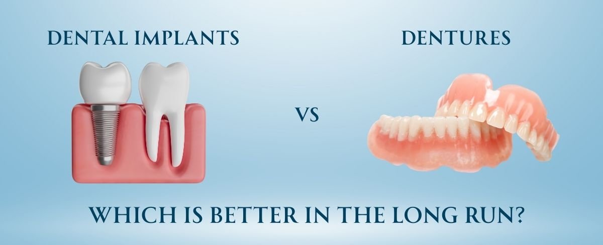 Dental Implants vs dentures