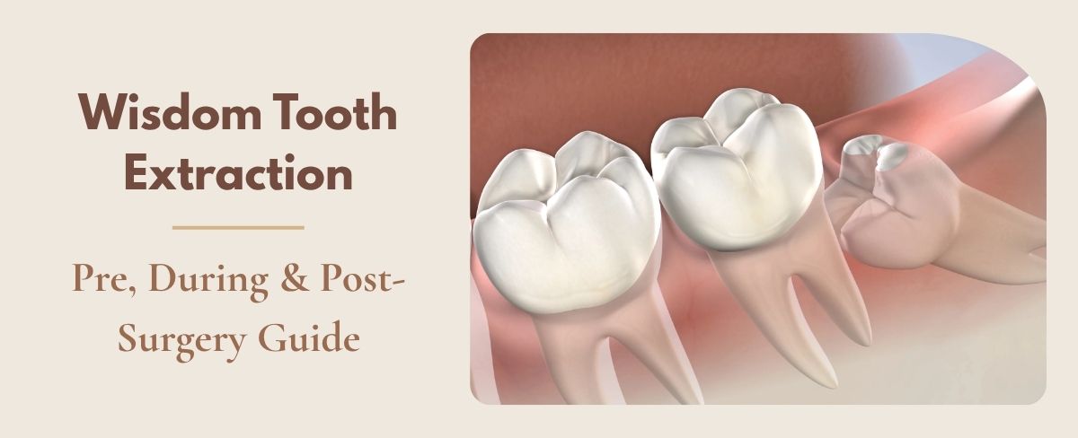 Wisdom Tooth Extraction