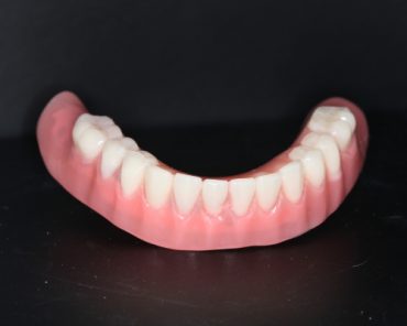 Dentures-AK-Dental-Clinic