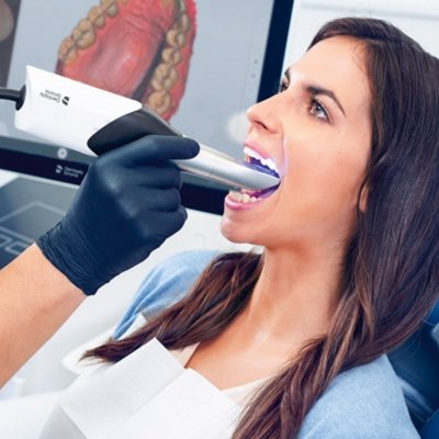 oral-scanner