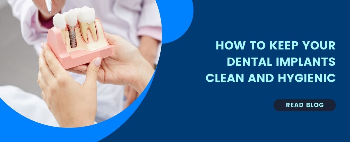 How-to-Keep-Your- Dental-Implants-Clean-and-Hygienic
