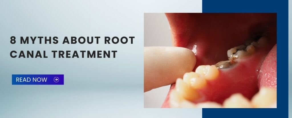 8-Myths-About-Root- Canal-Treatment
