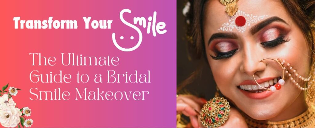 Bridal Smile Makeover