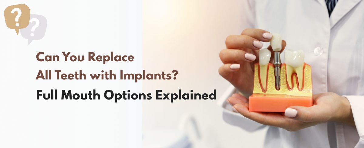 Can You Replace All Teeth with Implants