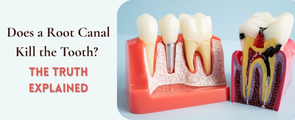 Does a Root Canal Kill the Tooth? The Truth Explained