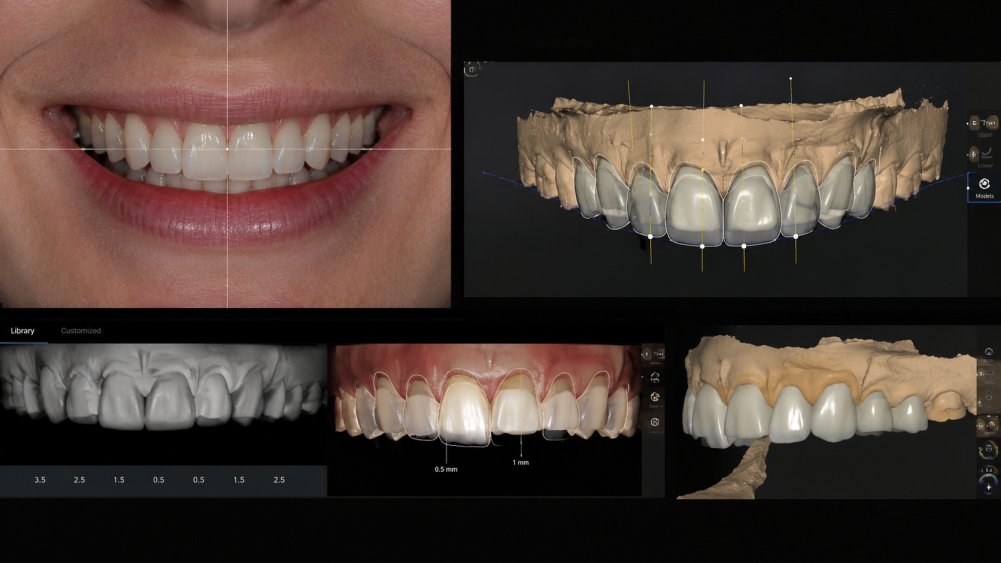 didital-smile-designing