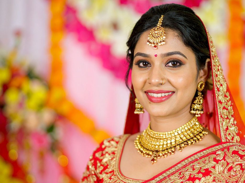 Bridal-smile-makeover