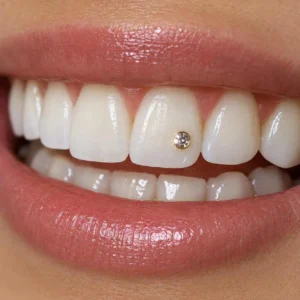 tooth-jewellery