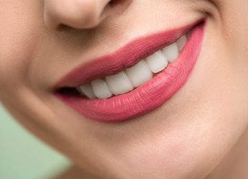 Cosmetic Smile Designing